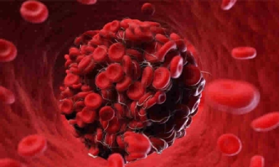 Proyecto de norma de MinSalud busca modificar las definiciones de los servicios con cargo al presupuesto máximo de la financiación de los medicamentos que requieran las personas que sean diagnosticadas por primera vez con una enfermedad huérfana